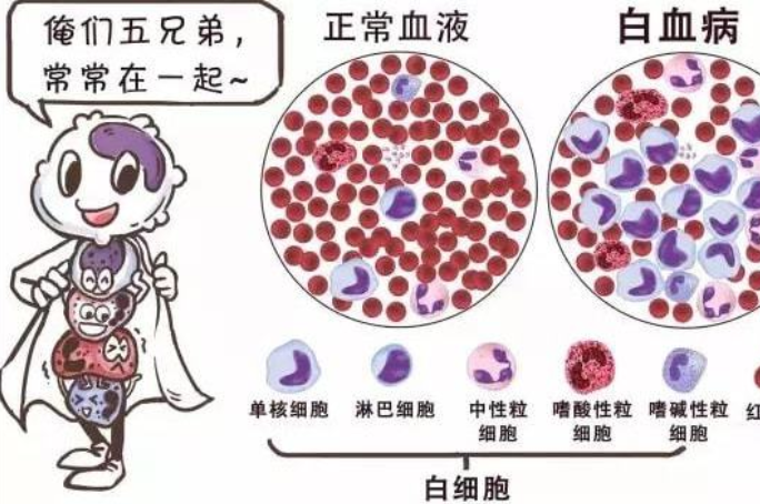 白血病的早期癥狀和前兆-白血病的早期癥狀和前兆如果發(fā)現(xiàn)