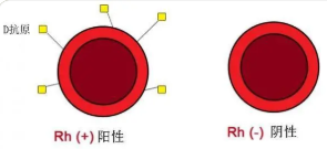 熊貓血是什么血型