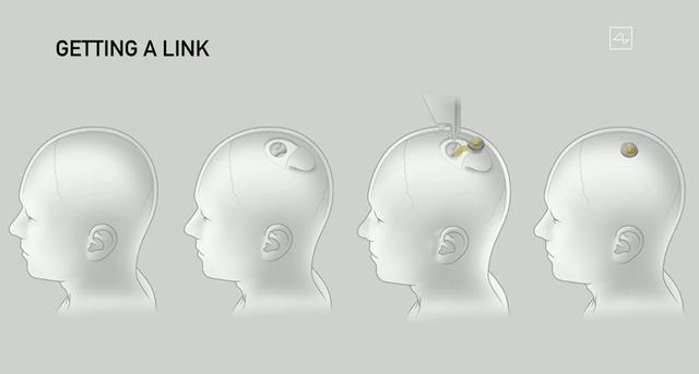 重磅！馬斯克旗下腦機(jī)接口公司Neuralink官宣：首次人體臨床試驗獲FDA批準(zhǔn)