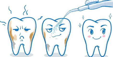 洗牙齒有什么好處和壞處（洗牙好處和壞處講解）