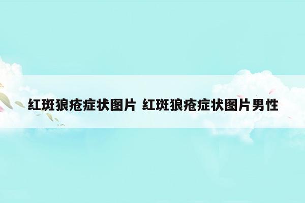 紅斑狼瘡癥狀圖片紅斑狼瘡癥狀圖片男性(紅斑狼瘡癥狀圖片展示)