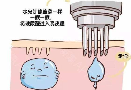 水光針的主要功效和副作用